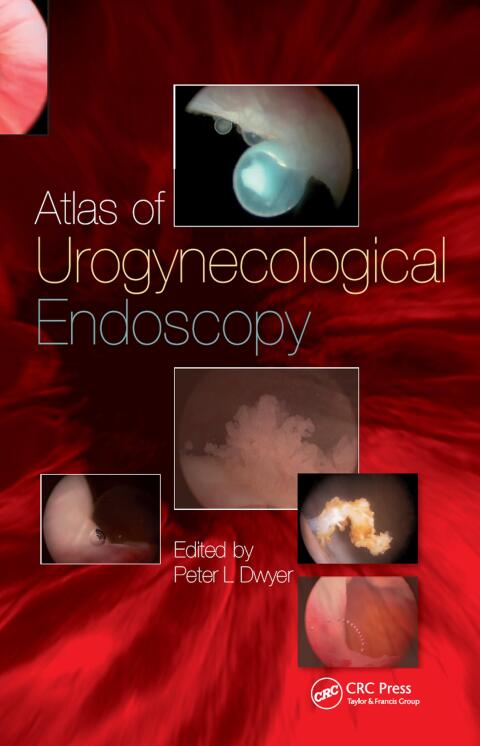 Cover image for book Handbook of Urologic Cryoablation