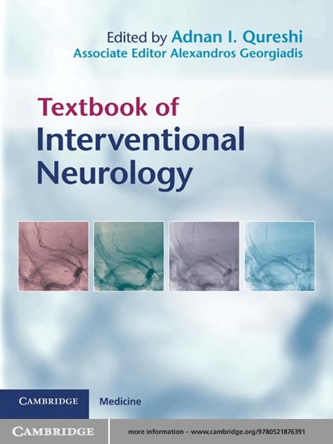 Cover image for book Textbook of Interventional Neurology