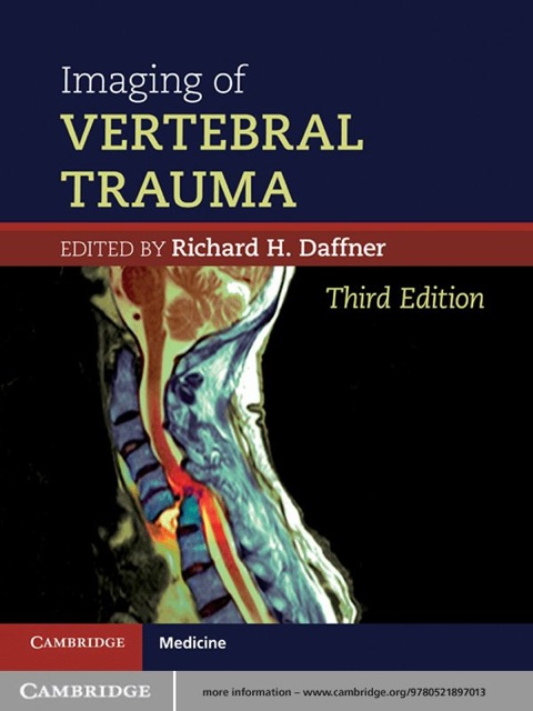 Cover image for book Imaging of Vertebral Trauma