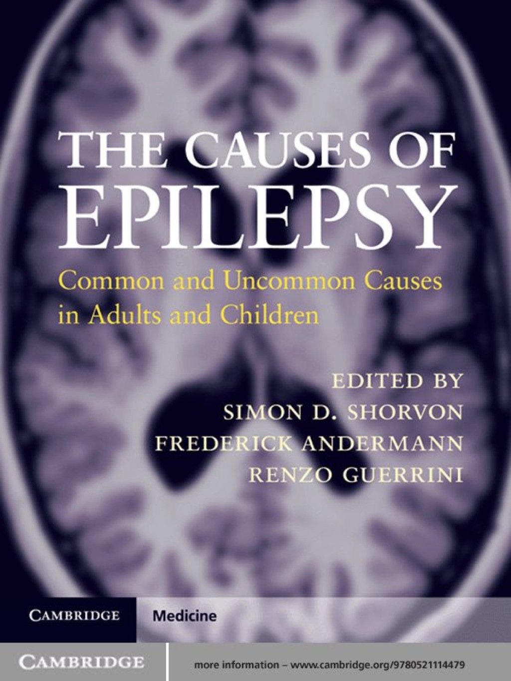 The Causes of Epilepsy - 1st Edition (eBook)