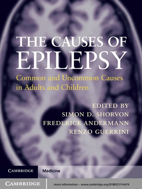 Cover image for book The Causes of Epilepsy