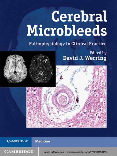 Cover image for book Cerebral Microbleeds