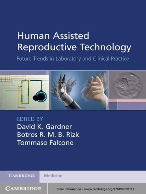 Human Assisted Reproductive Technology 