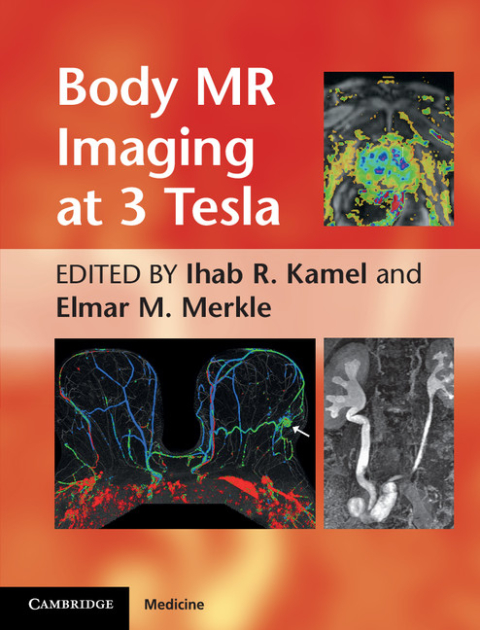 Cover image for book Body MR Imaging at 3 Tesla