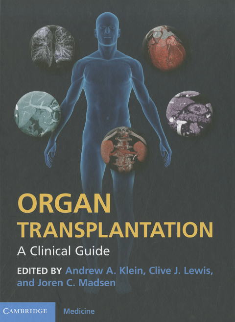 Cover image for book Organ Transplantation