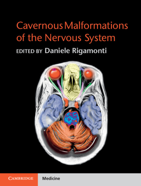 Cover image for book Cavernous Malformations of the Nervous System