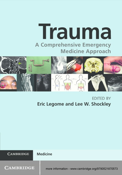 Cover image for book Trauma