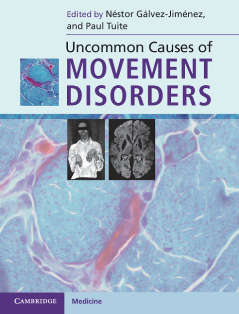Cover image for book Uncommon Causes of Movement Disorders