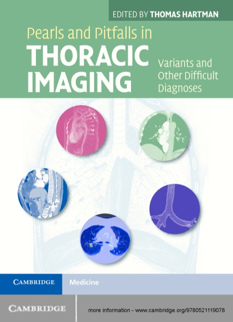 Pearls and Pitfalls in Thoracic Imaging 