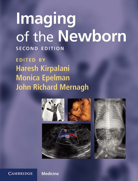 Cover image for book Imaging of the Newborn
