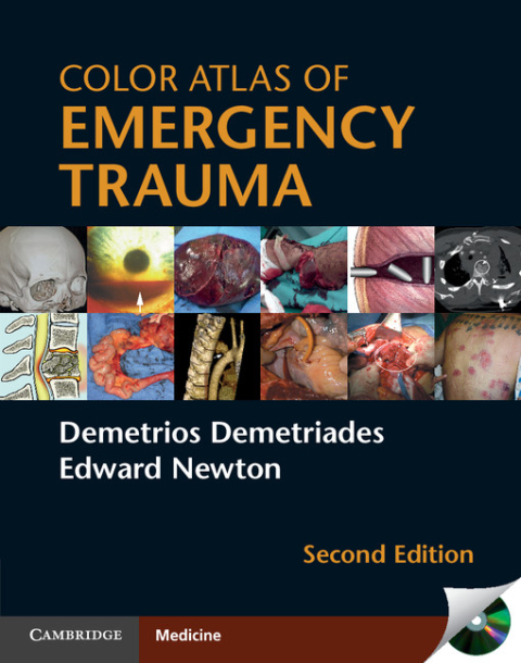 Cover image for book Color Atlas of Emergency Trauma