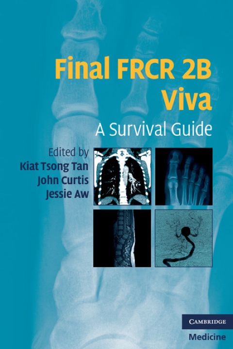 Final FRCR 2B Viva 