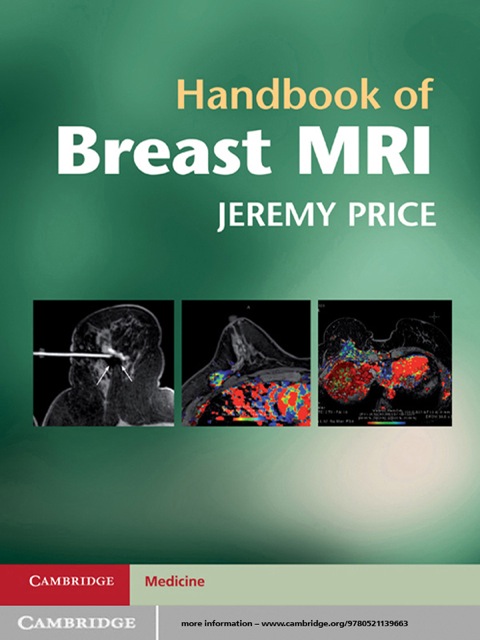 Cover image for book Handbook of Breast MRI