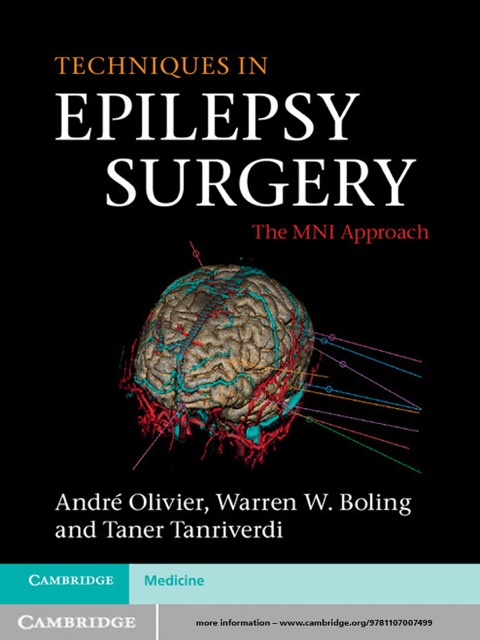 Cover image for book Techniques in Epilepsy Surgery