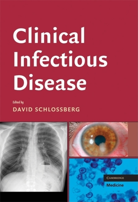 Cover image for book Clinical Infectious Disease
