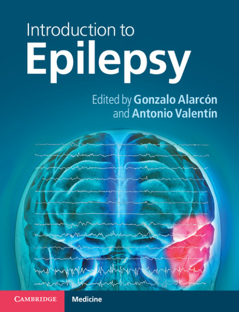Cover image for book Introduction to Epilepsy