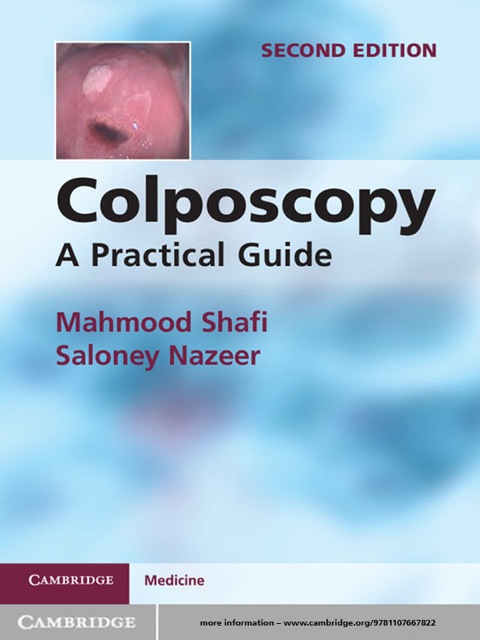 Cover image for book Colposcopy