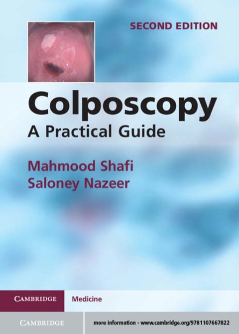 Cover image for book Colposcopy