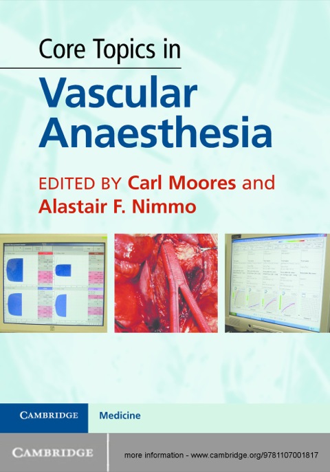 Cover image for book Core Topics in Vascular Anaesthesia