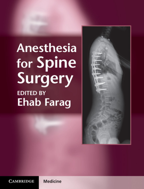 Cover image for book Anesthesia for Spine Surgery