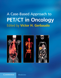 Titelbild: A Case-Based Approach to PET/CT in Oncology 1st edition 9780521116831