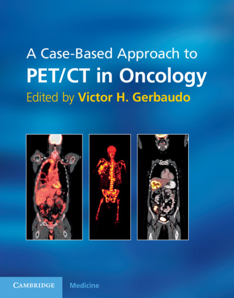 Cover image for book A Case-Based Approach to PET/CT in Oncology