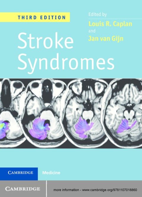 Stroke Syndromes, 3ed 