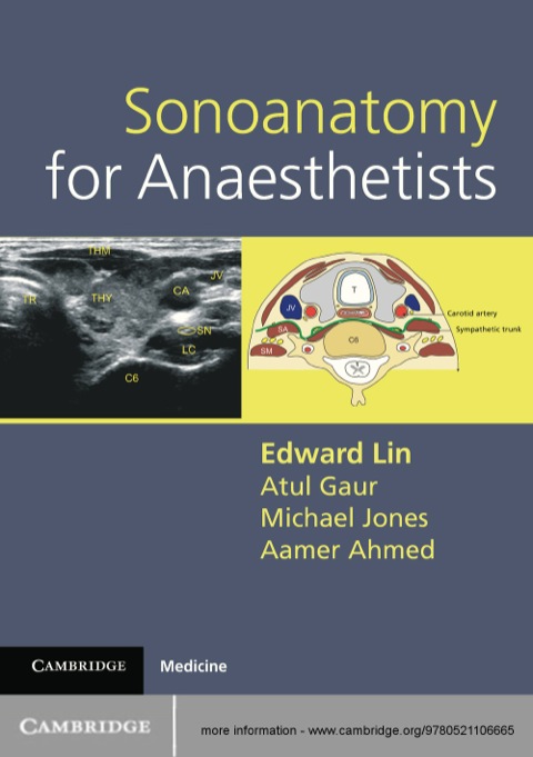 Cover image for book Sonoanatomy for Anaesthetists