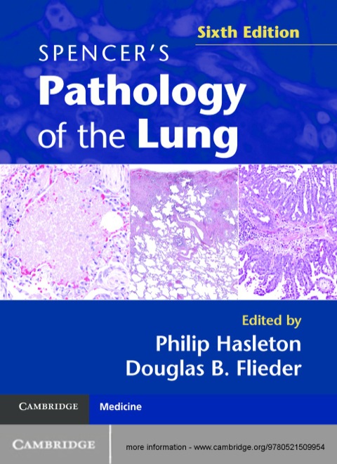 Cover image for book Spencer's Pathology of the Lung