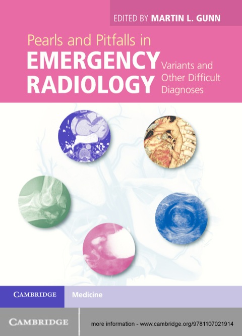 Cover image for book Pearls and Pitfalls in Emergency Radiology