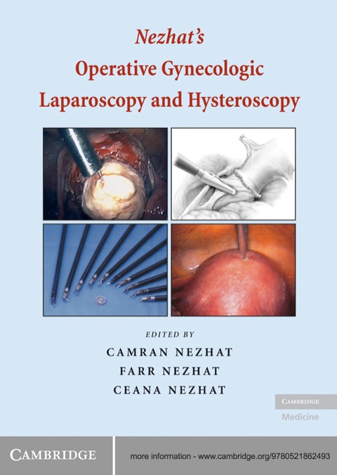 Cover image for book Nezhat's Operative Gynecologic Laparoscopy and Hysteroscopy