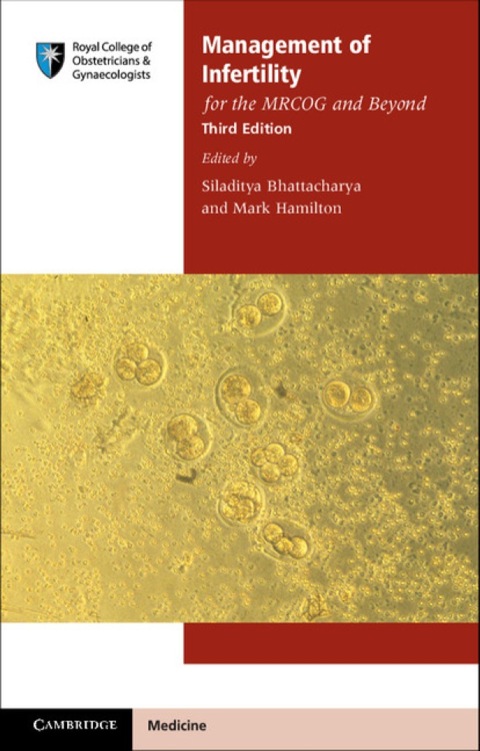 Cover image for book Management of Infertility for the MRCOG and Beyond
