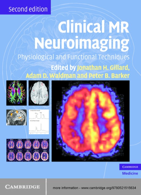 Cover image for book Clinical MR Neuroimaging