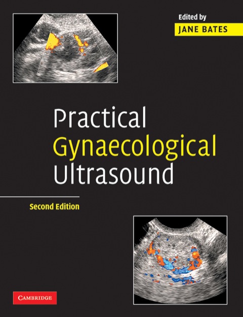 Practical Gynaecological Ultrasound 