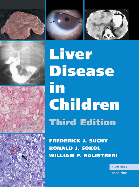 Cover image for book Liver Disease in Children