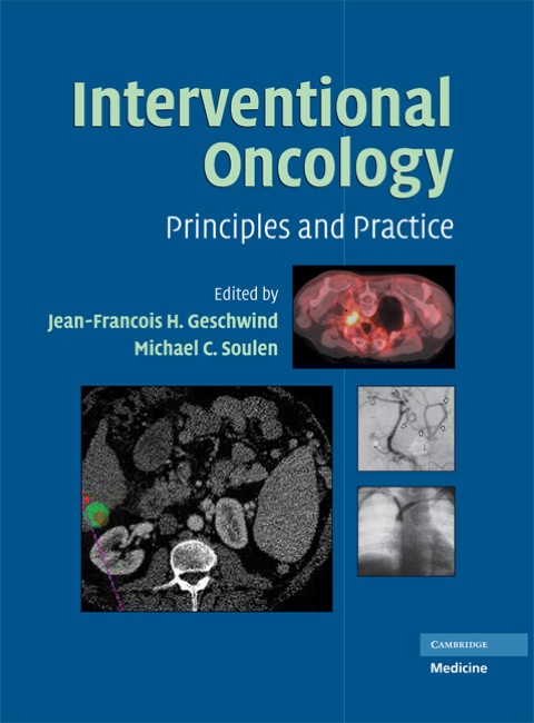 Cover image for book Interventional Oncology