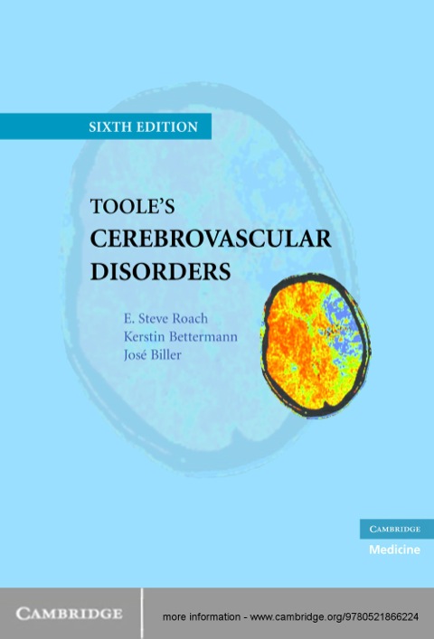 Cover image for book Toole's Cerebrovascular Disorders