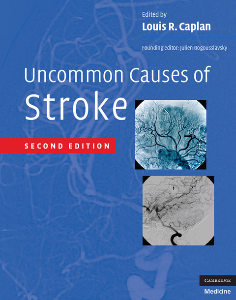 Uncommon Causes of Stroke 