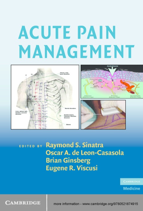 Cover image for book Acute Pain Management