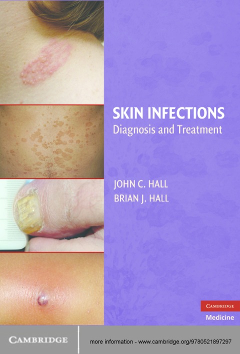 Cover image for book Skin Infections