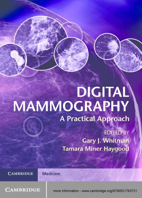 Cover image for book Digital Mammography