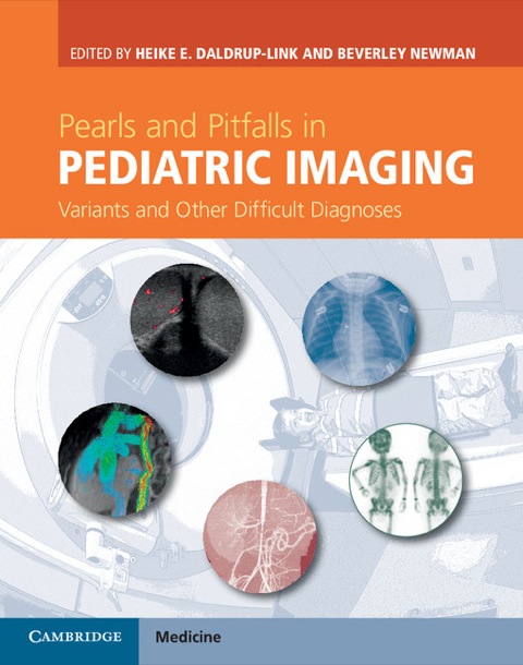 Cover image for book Pearls and Pitfalls in Pediatric Imaging