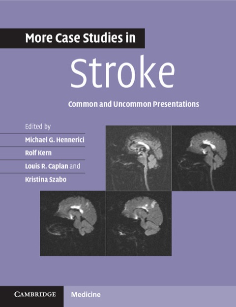 More Case Studies in Stroke 