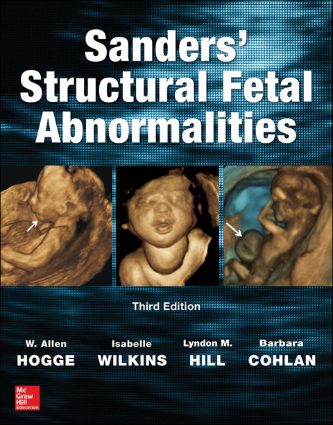 Cover image for book Sanders' Structural Fetal Abnormalities, Third Edition