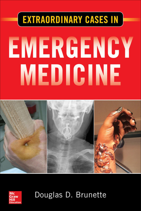 Cover image for book Extraordinary Cases in Emergency Medicine