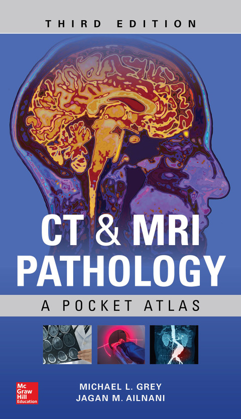 Cover image for book CT & MRI Pathology: A Pocket Atlas