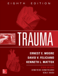 Trauma, 8th Edition