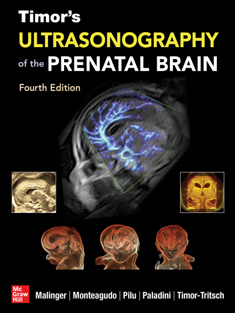 Cover image for book Timor's Ultrasonography of the Prenatal Brain