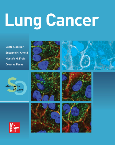 Cover image for book Lung Cancer:  Standards of Care