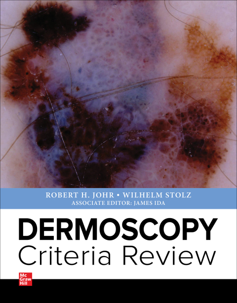 Cover image for book Dermoscopy  Criteria Review